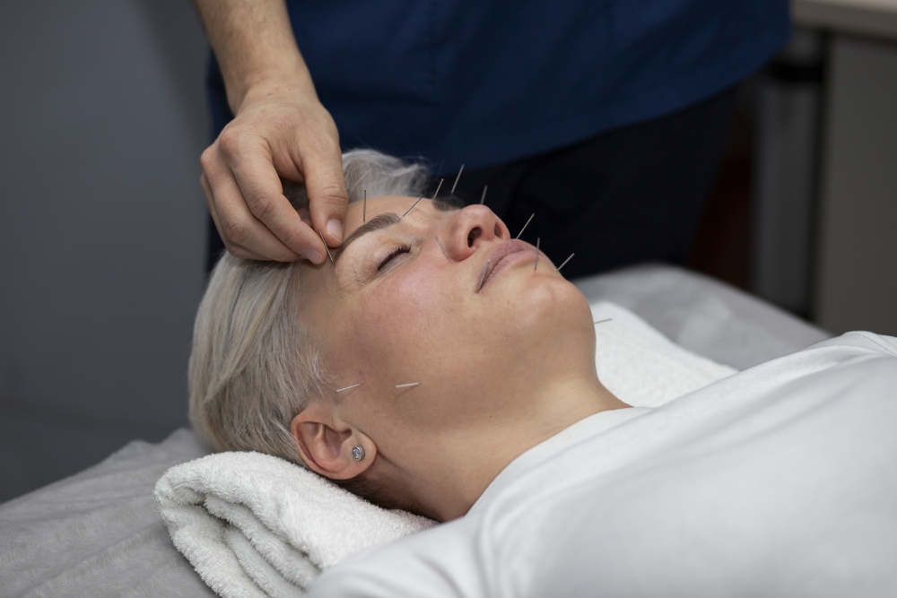 Acupuncture; Cosmetic; Facial; Rejuvenation; wrinkle; acne; rosasia